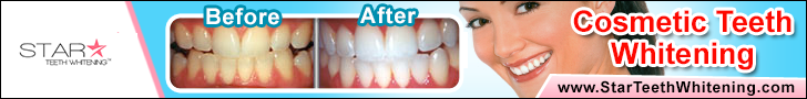 22% Star Teeth Whitening™ Gel